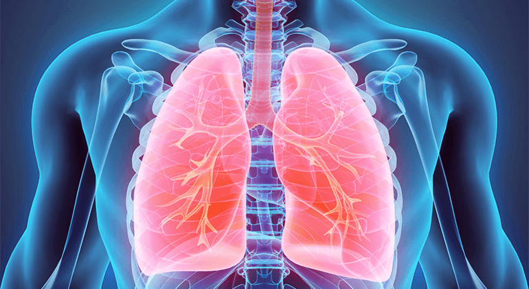 Lung Disease is quite extensive, but the two main conditions under it are asthma and chronic obstructive pulmonary disease (COPD).